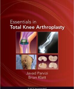 Essentials in Total Knee Arthroplasty 1st Edition
