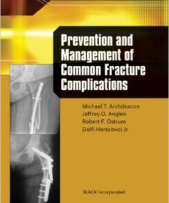 Prevention and Management of Common Fracture Complications 1st Edition