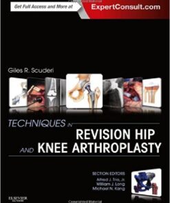 Techniques in Revision Hip and Knee Arthroplasty, 1e 1 Har/Psc Edition