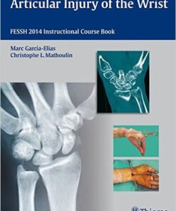 Articular Injury of the Wrist: FESSH 2014 Instructional Course Book 1st Edition