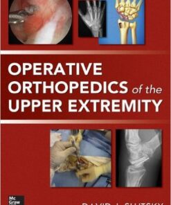 Operative Orthopedics of the Upper Extremity 1st Edition