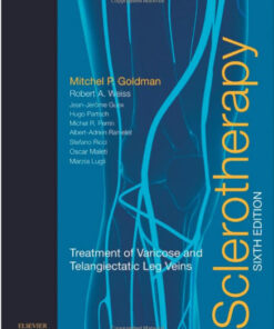 Sclerotherapy: Treatment of Varicose and Telangiectatic Leg Veins, 6e 6th Edition PDF
