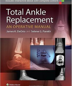 Total Ankle Replacement: An Operative Manual First Edition