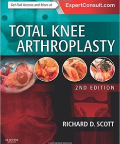 Total Knee Arthroplasty, 2e 2nd Edition