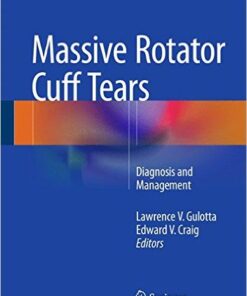 Massive Rotator Cuff Tears: Diagnosis and Management 2015th Edition