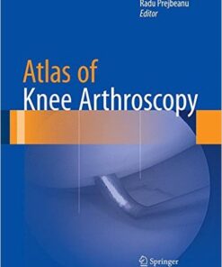Atlas of Knee Arthroscopy 2015th Edition