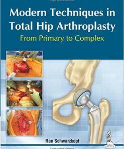 Modern Techniques in Total Hip Arthroplasty: From Primary to Complex 1st Edition