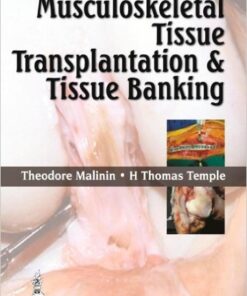 Musculoskeletal Tissue Transplantation and Tissue Banking 1st Edition