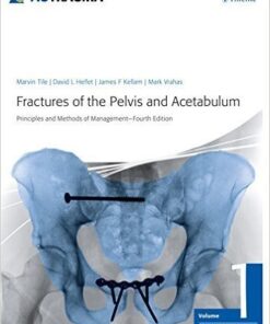 Fractures of the Pelvis and Acetabulum: Principles and Methods of Management by Marvin Tile