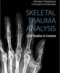 Skeletal Trauma Analysis: Case Studies in Context 1st Editionv