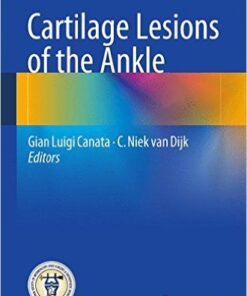 Cartilage Lesions of the Ankle 2015th Edition