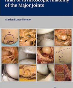 Atlas of Arthroscopic Anatomy of Major Joints 1st Edition