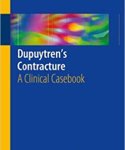 Dupuytren's Contracture: A Clinical Casebook 1st ed. 2016 Edition
