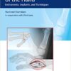 Osteosynthesis of the Hand: Instruments, Implants, and Techniques 1st Edition