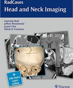 RadCases Head and Neck Imaging