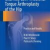 Charnley Low-Frictional Torque Arthroplasty of the Hip 2016 : Practice and Results