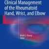 Clinical Management of the Rheumatoid Hand, Wrist, and Elbow 2016