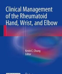 Clinical Management of the Rheumatoid Hand, Wrist, and Elbow 2016