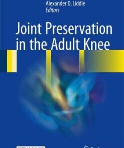 Joint Preservation in the Adult Knee 2017