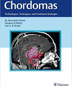 Chordomas: Technologies, Techniques, and Treatment Strategies 1st Edition PDF