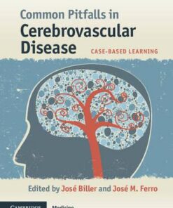 Common Pitfalls in Cerebrovascular Disease: Case-Based Learning 1st Edition