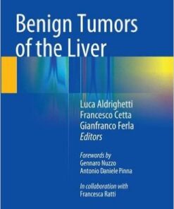 Benign Tumors of the Liver  1st ed. 2015 Edition
