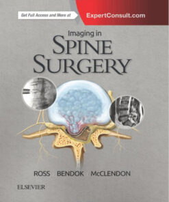 Imaging in Spine Surgery, 1e (Hot Topics)