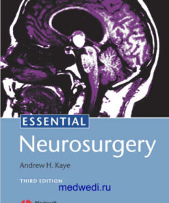 Essential Neurosurgery 3rd Edition PDF