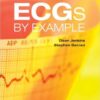 ECGs by Example, 3e 3rd Edition