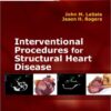 Interventional Procedures for Adult Structural Heart Disease Expert Consult – Online and Print