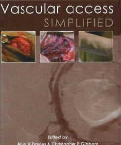 Vascular Access Simplified Edition 2