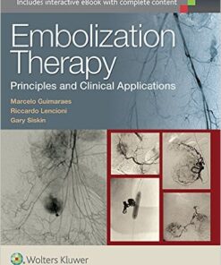 Embolization Therapy: Principles and Clinical Applications