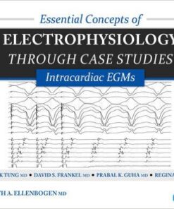 Essential Concepts of Electrophysiology through Case Studies: Intracardiac EGMs
