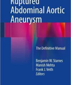 Ruptured Abdominal Aortic Aneurysm 2016 : The Definitive Manual