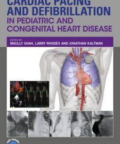 Cardiac Pacing and Defibrillation in Pediatric and Congenital Heart Disease 1st Edition PDF