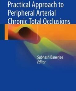 Practical Approach to Peripheral Arterial Chronic Total Occlusions 1st ed. 2017 Edition PDF