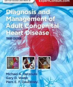 Diagnosis and Management of Adult Congenital Heart Disease, 3e 3rd Edition PDF