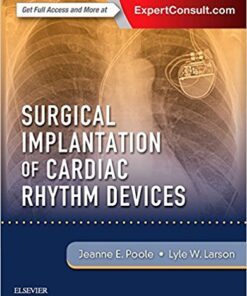 Surgical Implantation of Cardiac Rhythm Devices, 1e  PDF