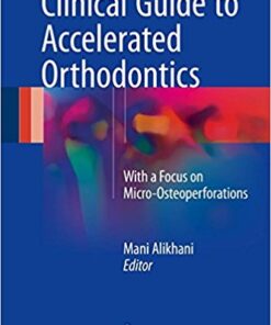 Clinical Guide to Accelerated Orthodontics: With a Focus on Micro-Osteoperforations 1st ed. 2017 Edition PDF
