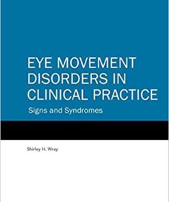 Eye Movement Disorders in Clinical Practice: Signs and Syndromes