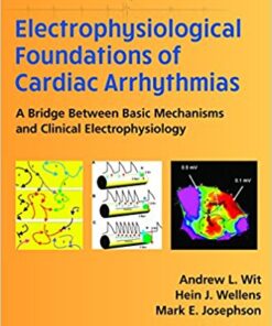 Electrophysiological Foundations of Cardiac Arrhythmias: A Bridge Between Basic Mechanisms and Clinical Electrophysiology 1st Edition PDF