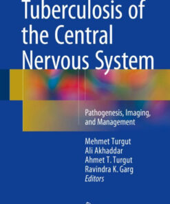 Tuberculosis of the Central Nervous System: Pathogenesis, Imaging, and Management 1st ed. 2017 Edition PDF