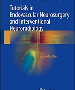 Tutorials in Endovascular Neurosurgery and Interventional Neuroradiology 2nd ed. 2017 Edition PDF