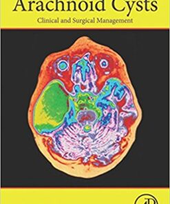 Arachnoid Cysts: Clinical and Surgical Management 1st Edition PDF