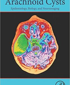 Arachnoid Cysts: Epidemiology, Biology, and Neuroimaging 1st Edition PDF