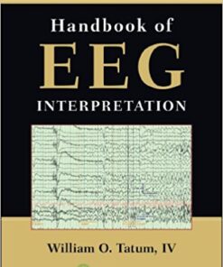 Handbook of EEG Interpretation, Second Edition 2nd Edition PDF
