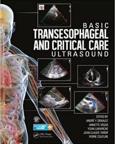 Basic Transesophageal and Critical Care Ultrasound EPUB