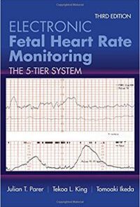Electronic Fetal Heart Rate Monitoring The 5-Tier System 3rd Edition PDF