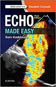 Echo Made Easy, 3rd Edition PDF