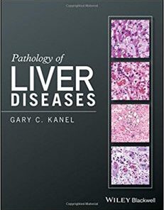 Pathology of Liver Diseases (PDF)